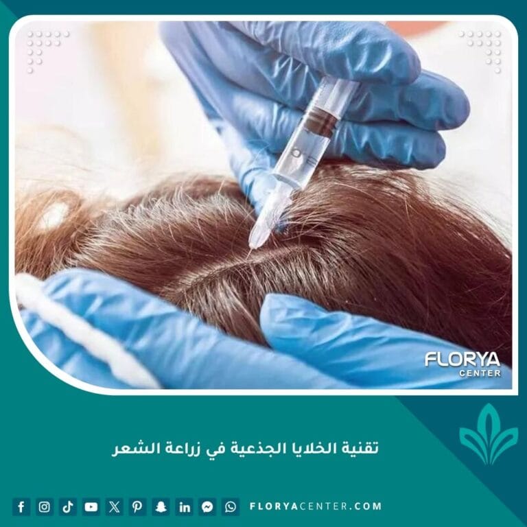 تقنية الخلايا الجذعية في زراعة الشعر