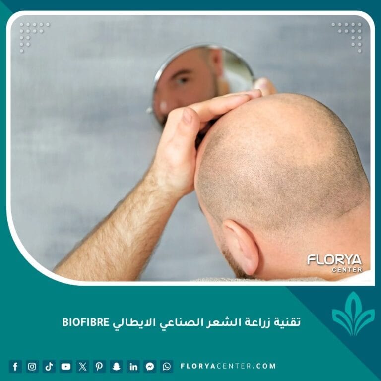 تقنية زراعة الشعر الصناعي الايطالي BIOFIBRE