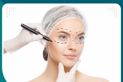 عملية تجميل العيون