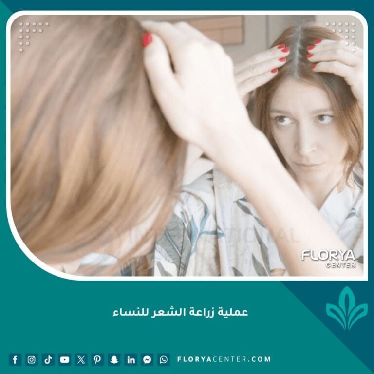 عملية زراعة الشعر للنساء