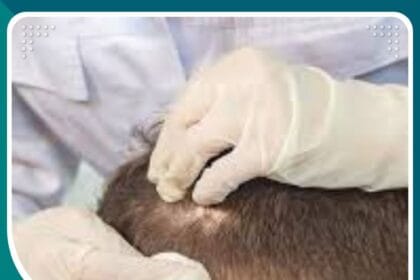 تقنية OSL في فتح القنوات