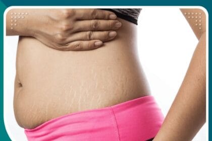 عمليات التجميل بعد الولادة