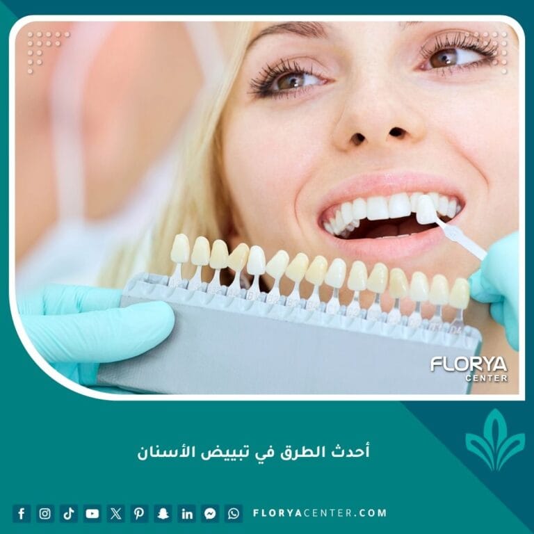 أحدث الطرق في تبييض الأسنان
