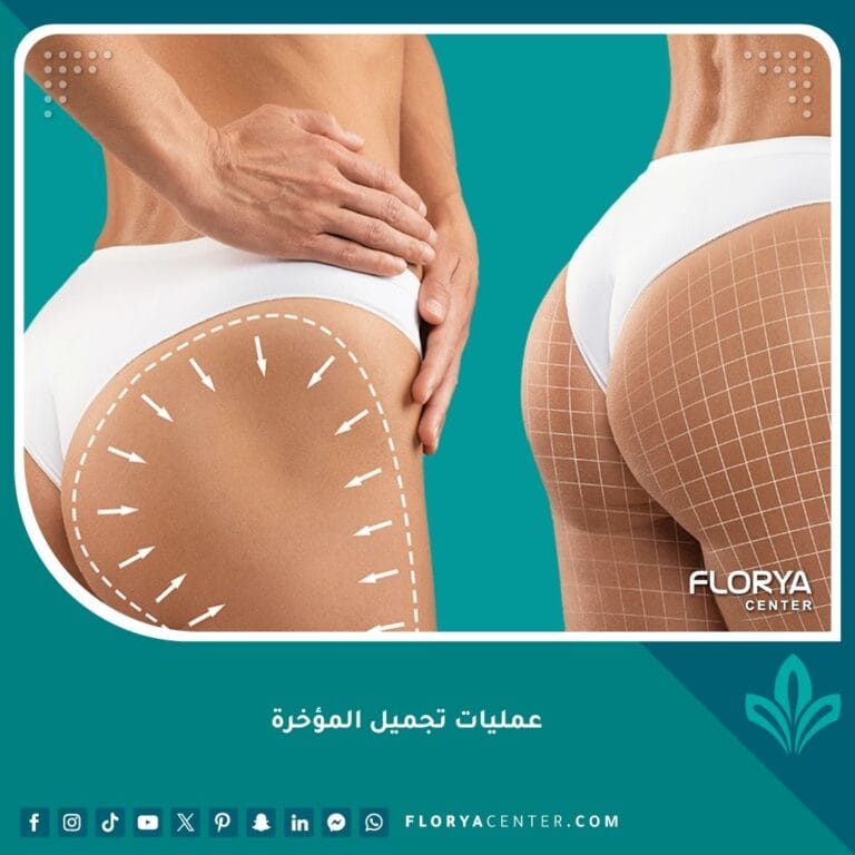 عمليات تجميل المؤخرة