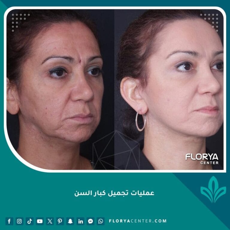 عمليات تجميل كبار السن