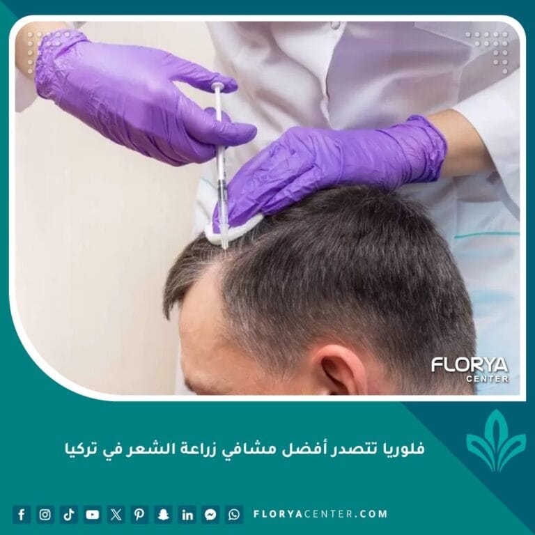 فلوريا تتصدر أفضل مشافي زراعة الشعر في تركيا