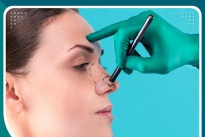 عملية تجميل الأنف