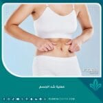 عملية شد الجسم