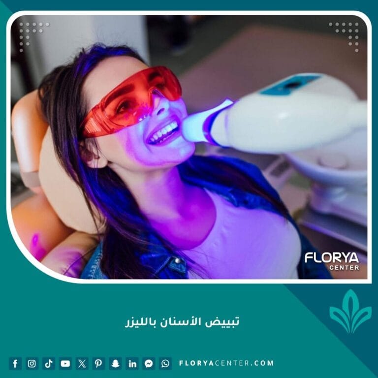 تبييض الأسنان بالليزر