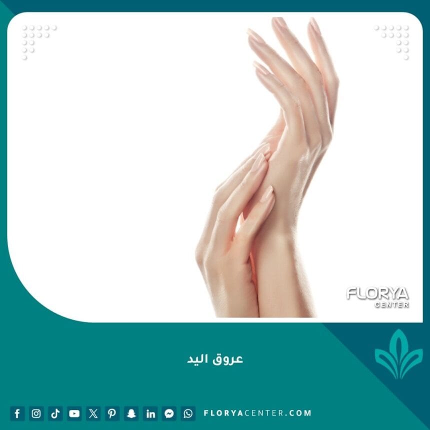 عروق اليد البارزة: 7 أسباب صحية وتجميلية لعلاجها فوراً!