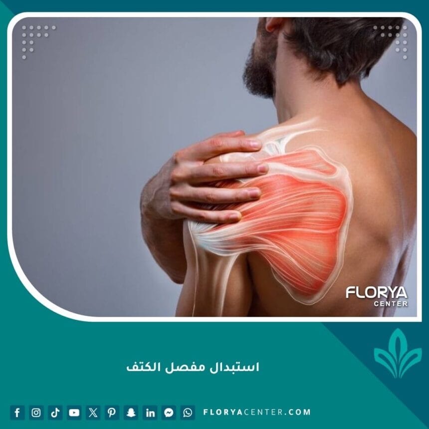 استبدال مفصل الكتف