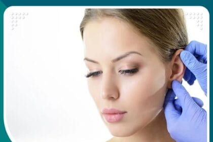 تجميل الأذن البارزة