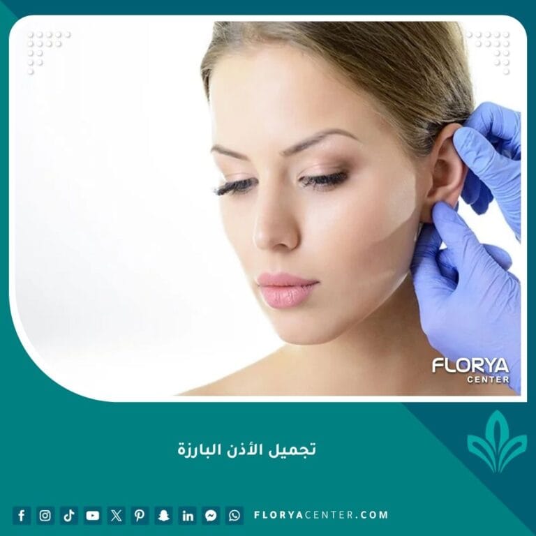 تجميل الأذن البارزة
