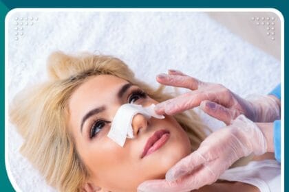 عمليات تجميل الأنف