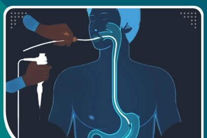 عمليات تكميم المعدة