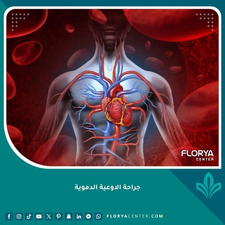 جراحة الاوعية الدموية