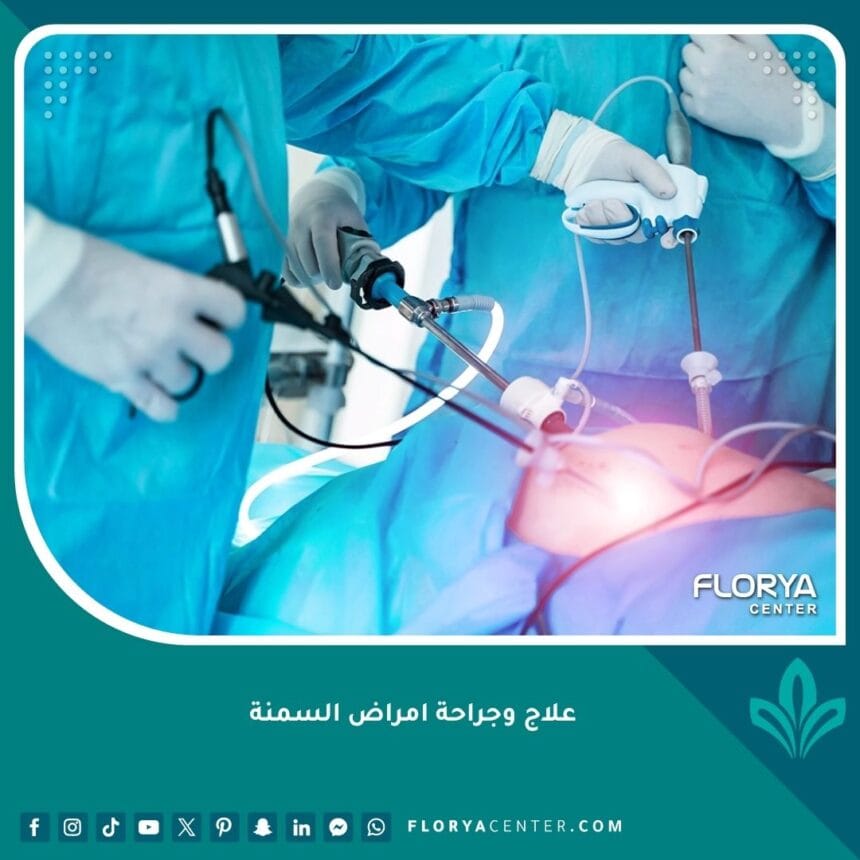 علاج وجراحة امراض السمنة