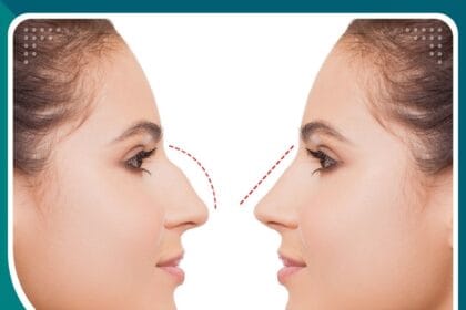 فيلر الأنف مشاكل الأنف التجميلية