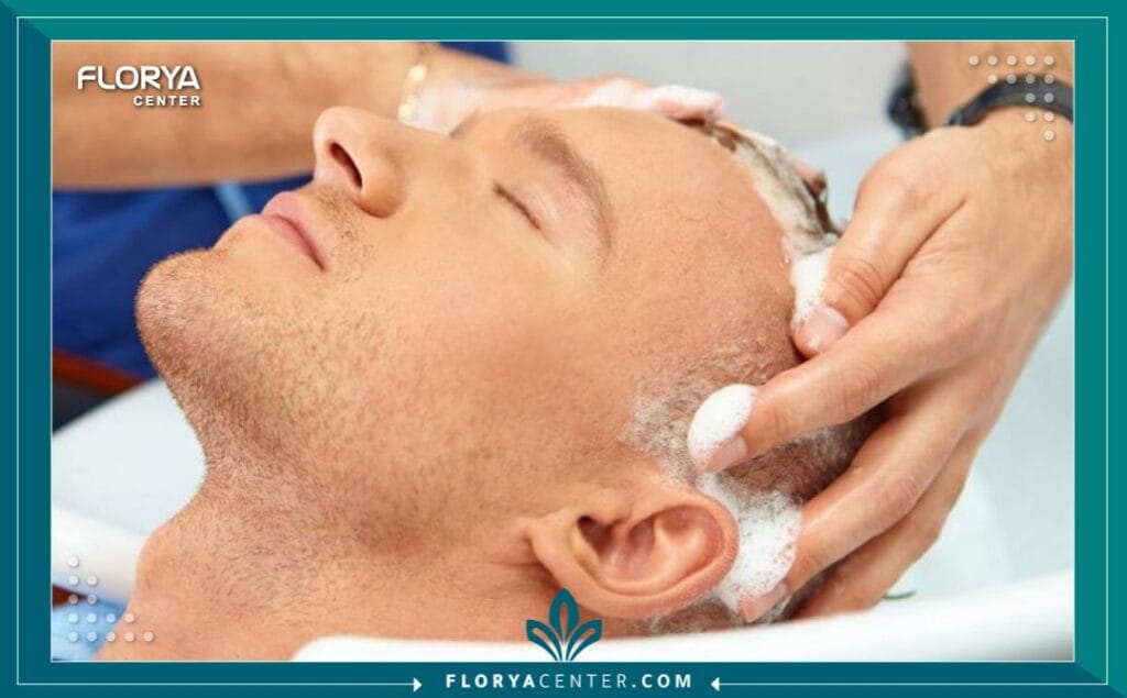 غسل الشعر بعد زراعة الشعر بالتفصيل