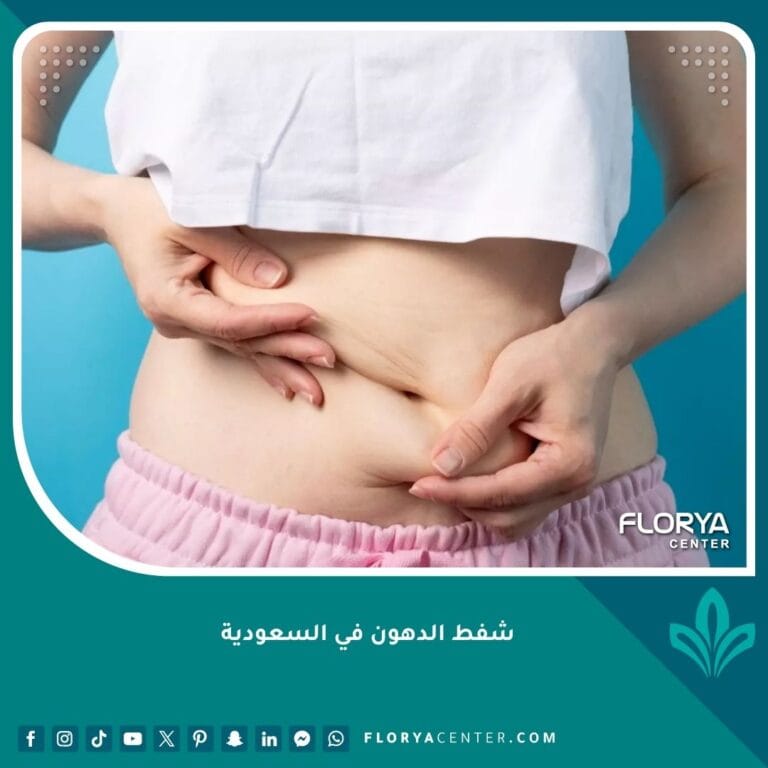 شفط الدهون في السعودية