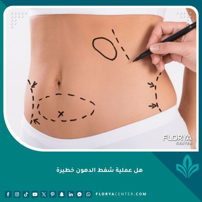 هل عملية شفط الدهون خطيرة