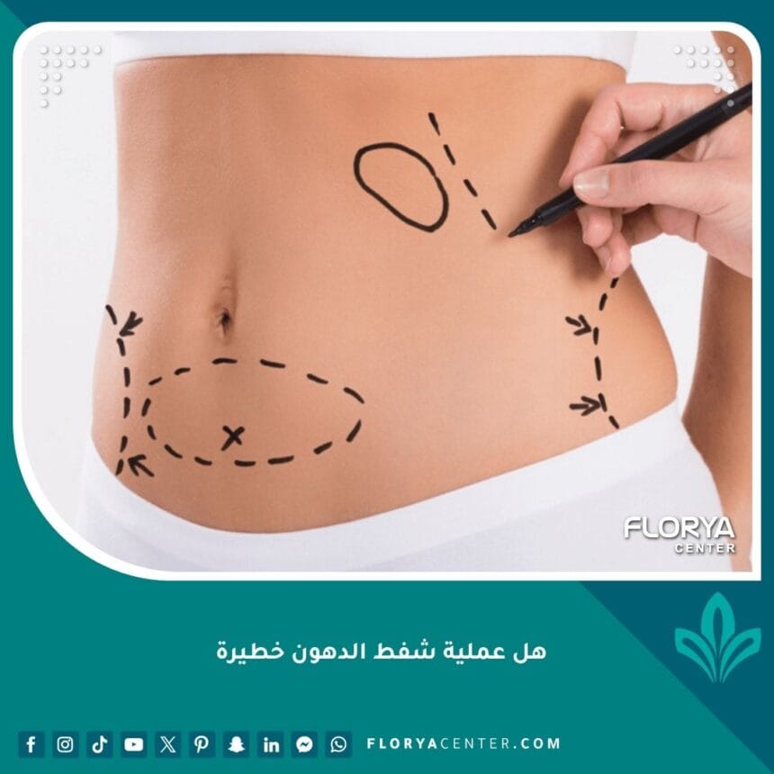 هل عملية شفط الدهون خطيرة