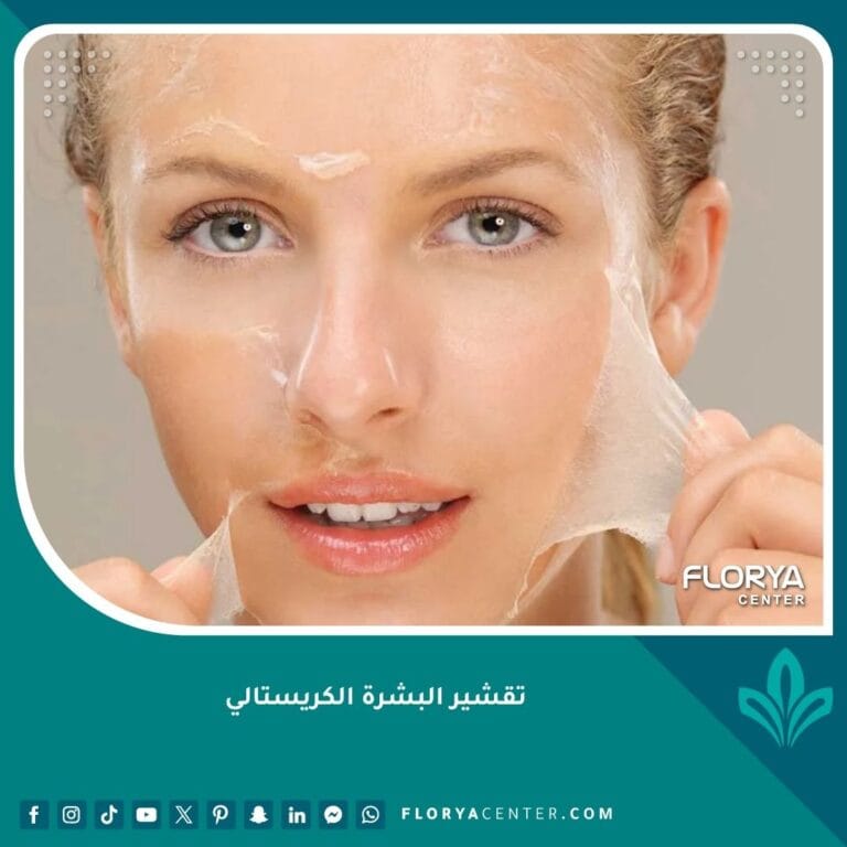 تقشير البشرة الكريستالي