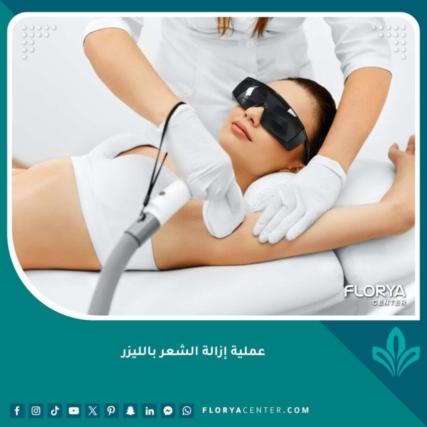 عملية إزالة الشعر بالليزر