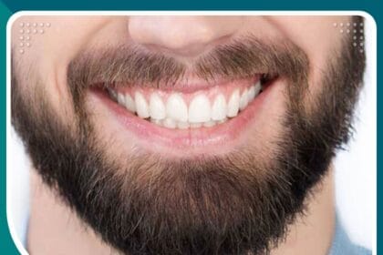 عملية تكثيف الشنب