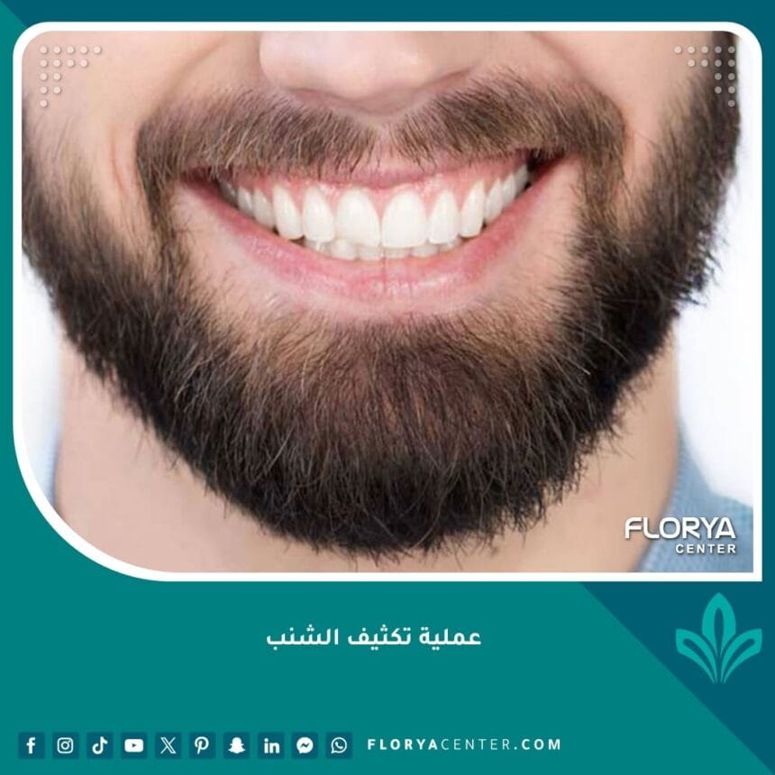 عملية تكثيف الشنب