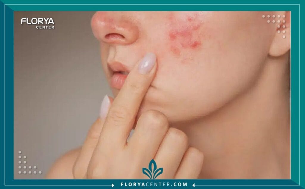 الامراض الجلدية 4 الامراض الجلدية