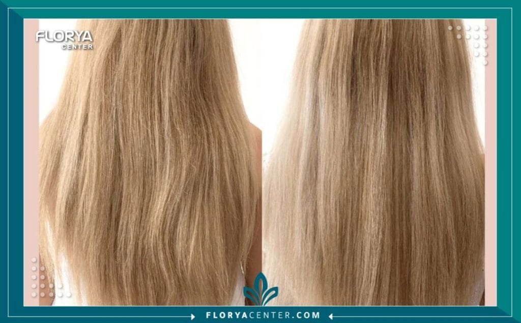 الكولاجين للشعر