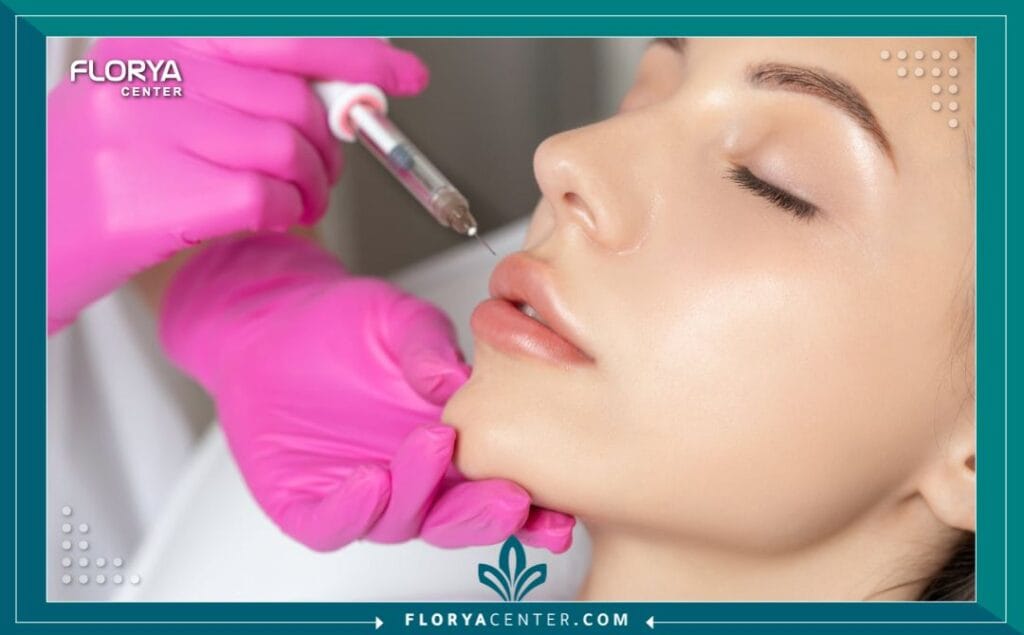 بوتكس الشفاه