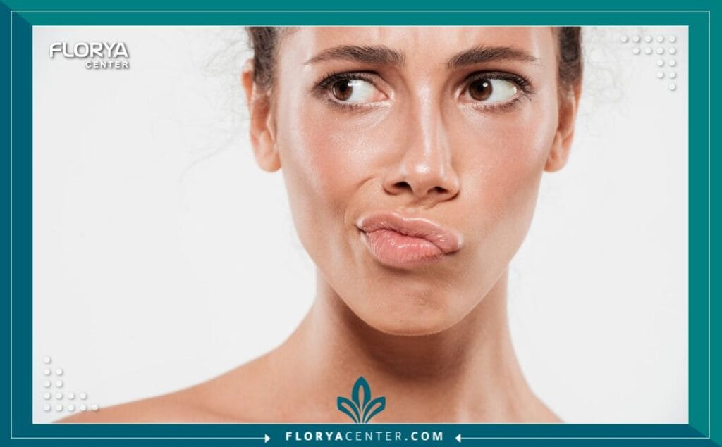 بوتكس الشفاه