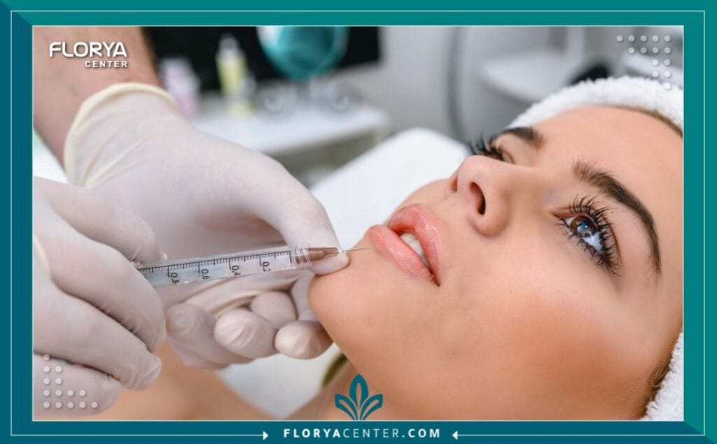 بوتكس الشفاه