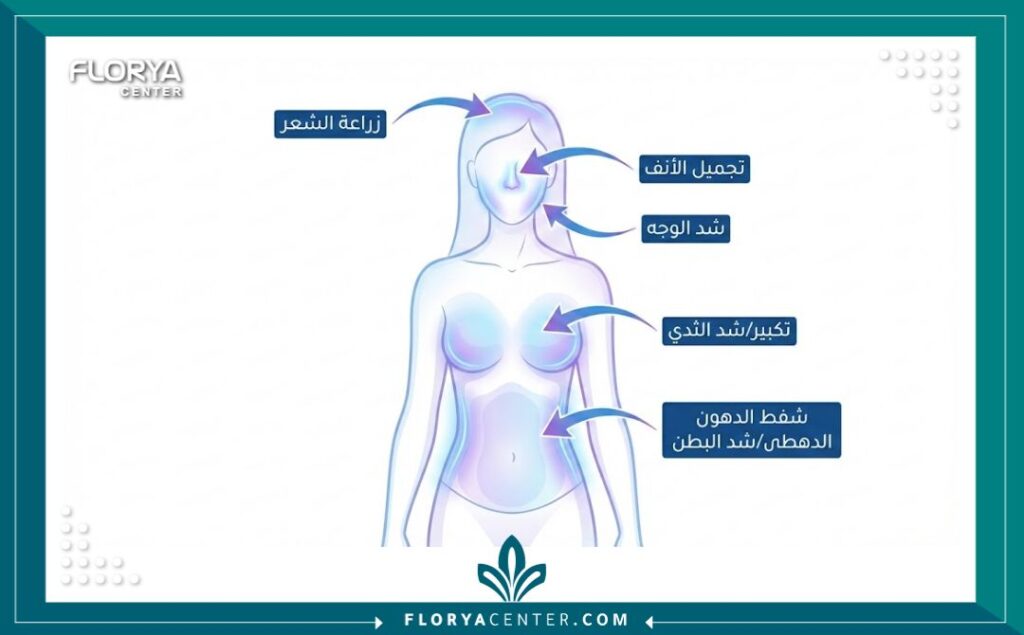 رسم توضيحي طبي يظهر مناطق الجسم الشائعة لإجراء عمليات جراحة التجميل في تركيا، مثل تجميل الأنف، شد الوجه، وتنسيق القوام مع تسميات باللغة العربية.