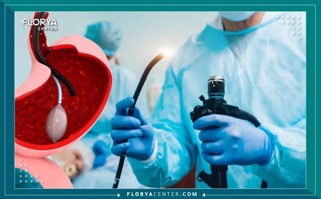 عملية بالون المعدة