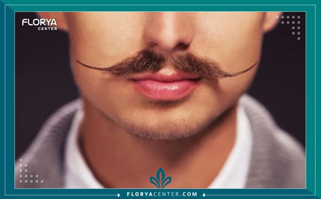 عملية تكثيف الشنب