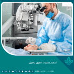 أسعار عمليات العيون بالليزر