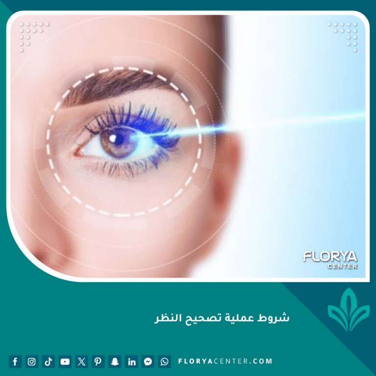 شروط عملية تصحيح النظر