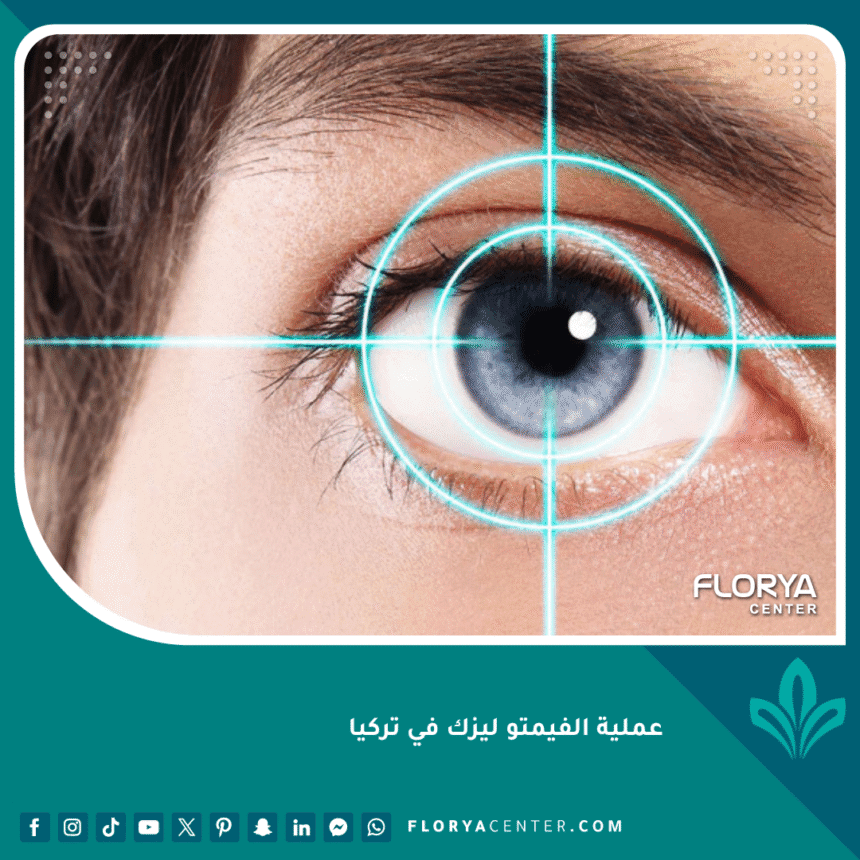 عملية الفيمتو ليزك في تركيا