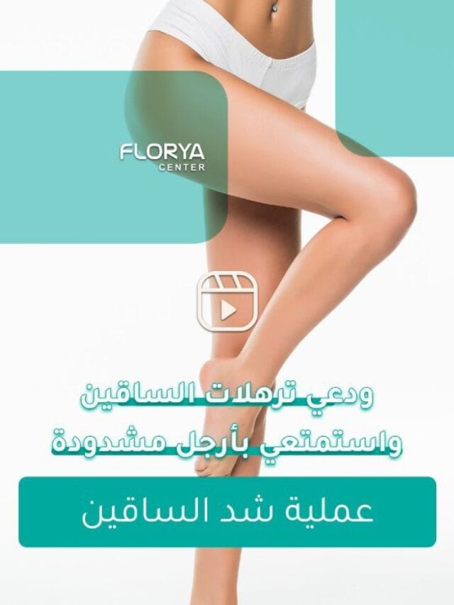 عملية شد الساقين