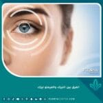 الفرق بين الليزك والفيتمو ليزك