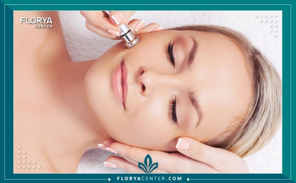 التقشير الالماسي