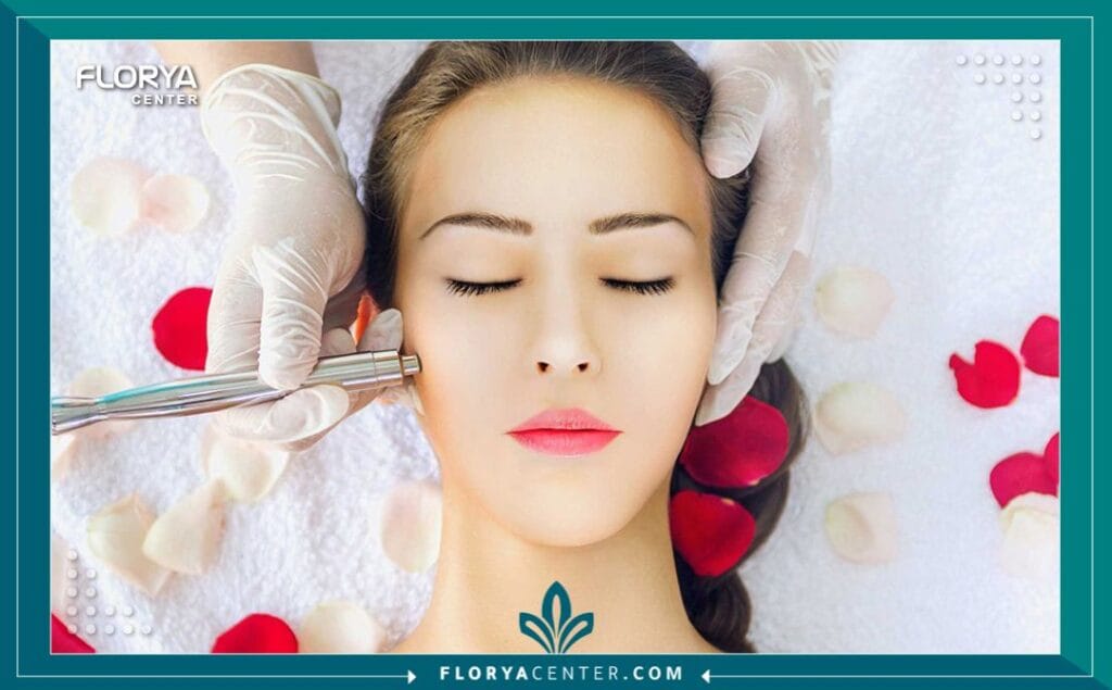 التقشير الالماسي