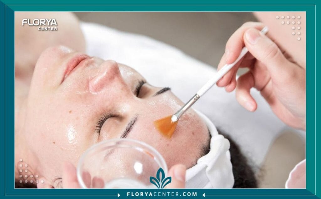 التقشير الالماسي