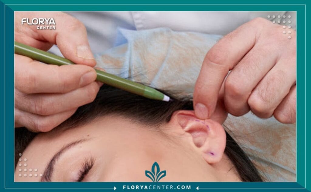 تجميل الأذن بدون جراحة