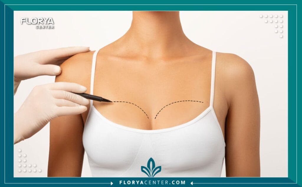 عملية تصغير الصدر في تركيا