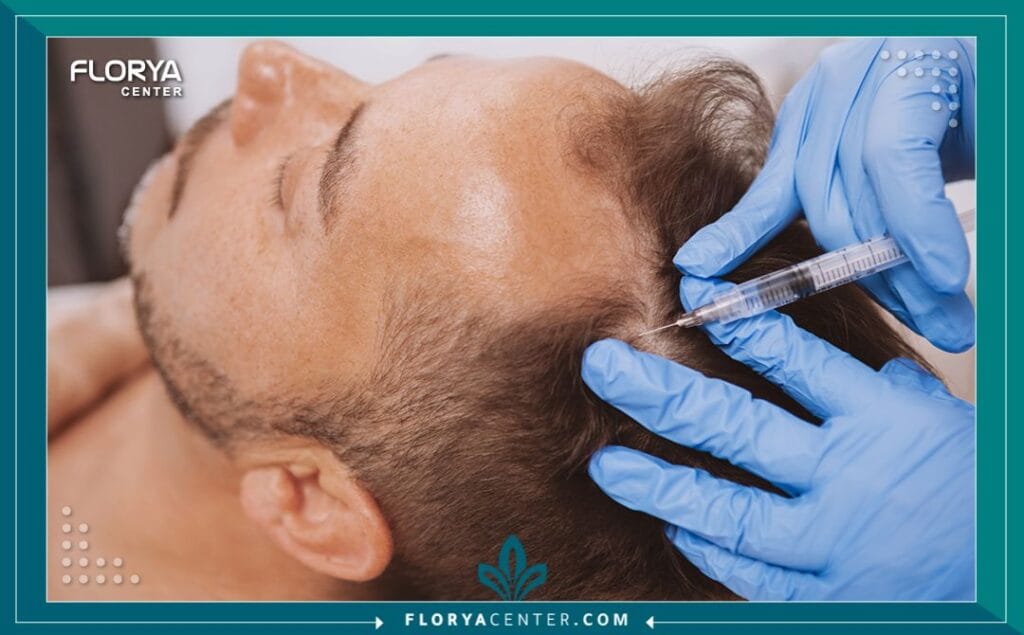 عملية زراعة الشعر الطبيعي