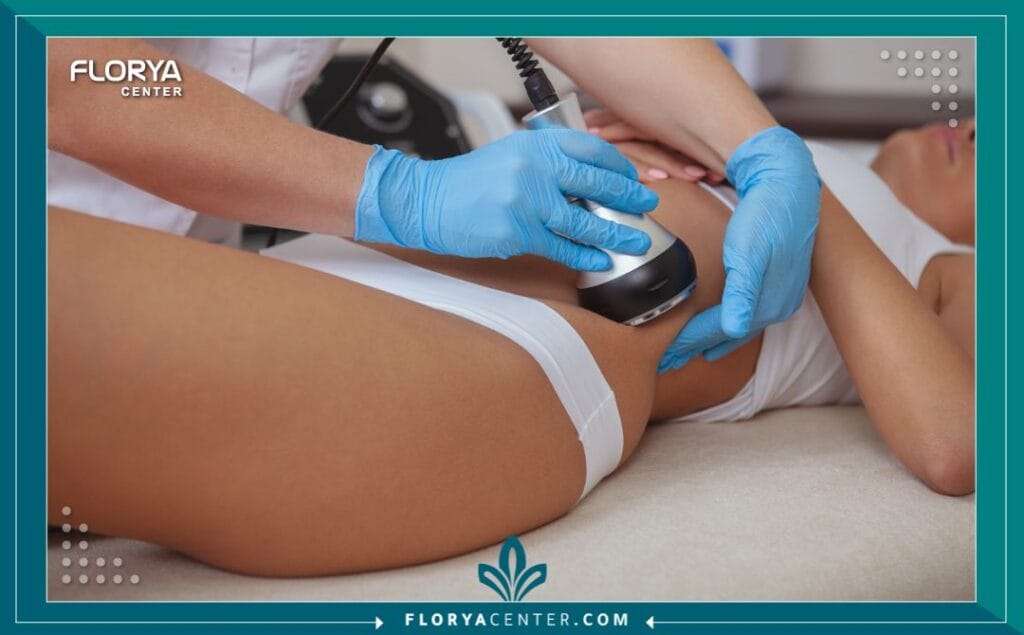 نحت الجسم بالليزر